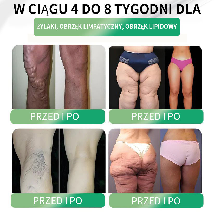🏆Widoczne rezultaty w 7 dni 🏆 | Lercea® GLP-1 Doustny Roztwór Odchudzający – 🌈 Otyłość, Choroby Sercowo-Naczyniowe, Cukrzyca, Bezdech Senny, Problemy ze Stawami i nie tylko