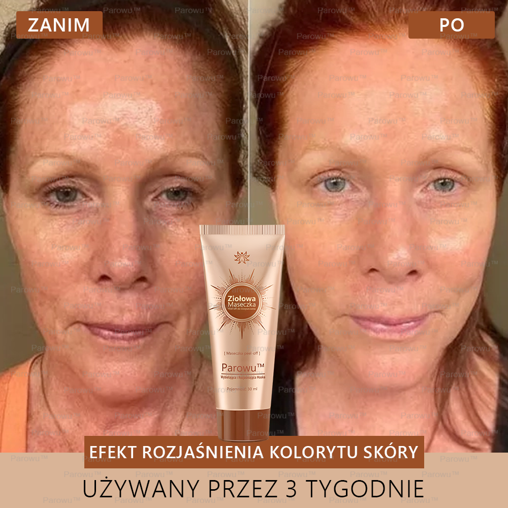 Parowu™ Wybielająca i Rozjaśniająca Maska - Naturalne składniki trwale usuwają plamy, piegi i przebarwienia✅✅✅